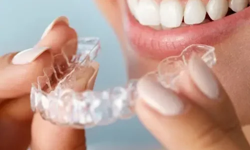 معلومات عن تجربتي مع قوالب التبييض