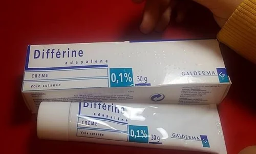 اعرف اكثر عن تجربتي مع ديفرين