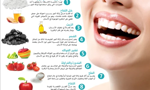 تجربتي مع جير الاسنان