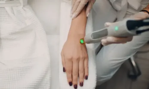 هل عادي اسوي ليزر وقت الدورة؟