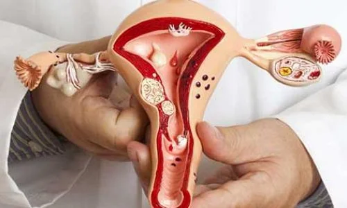 ماذا يعني وجود افرازات بنية مع دم خفيف؟