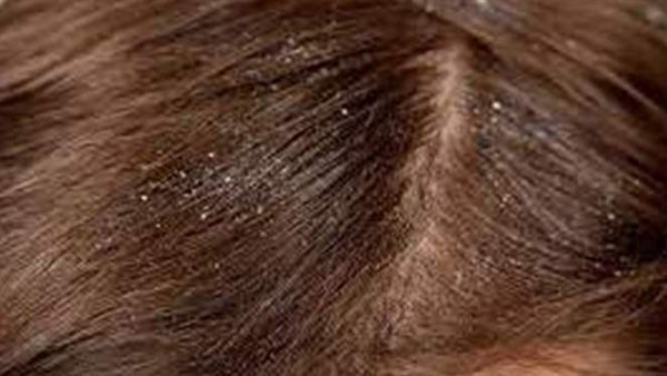 اعرف أكثر عن تفسير احلام القمل لابن سيرين