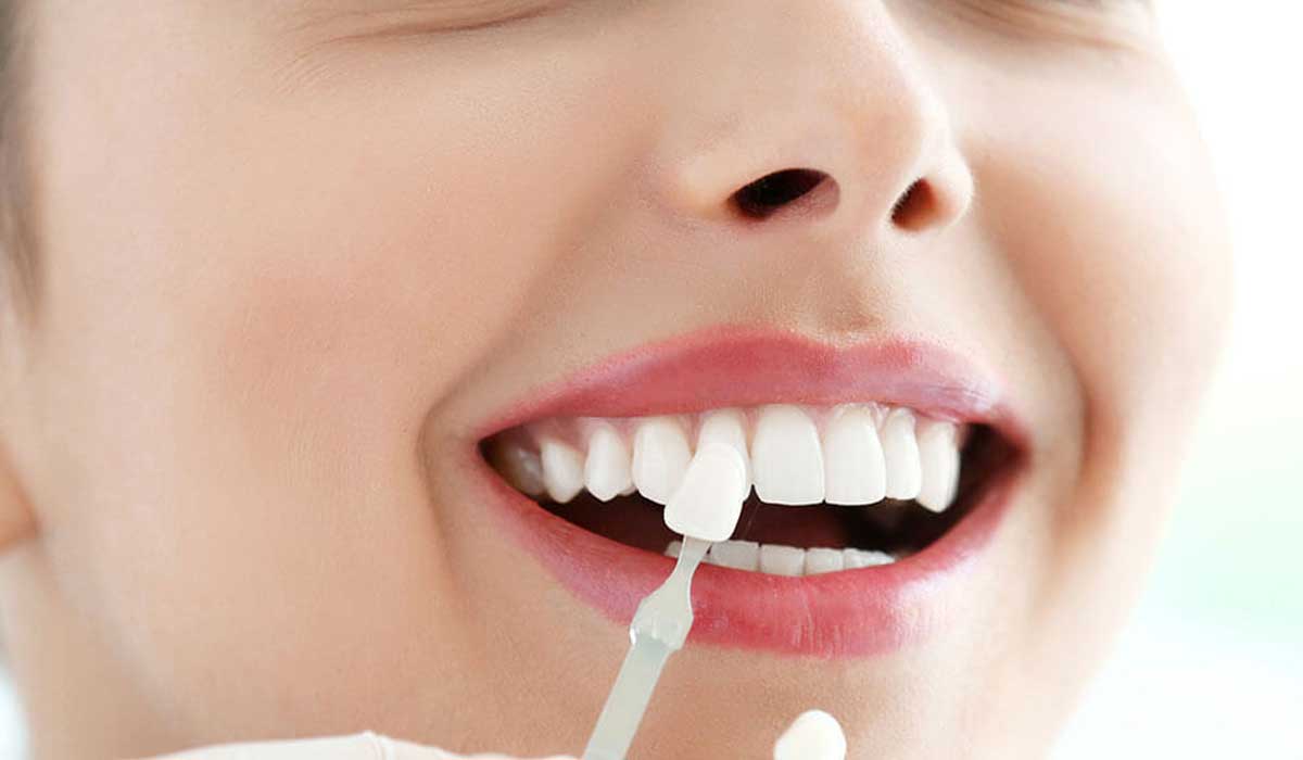 تعرف على تفسير حلم سقوط الأسنان بدون دم في المنام لابن سيرين